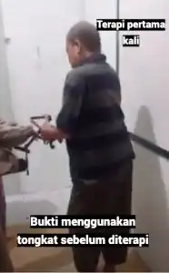 Datang Pakai Tongkat, Satu Kali Terapi Bebas Saraf Kejepit