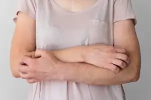 Kenali 8 Penyakit Kulit yang Sering Menyerang Tubuh dan Cara Mengatasinya